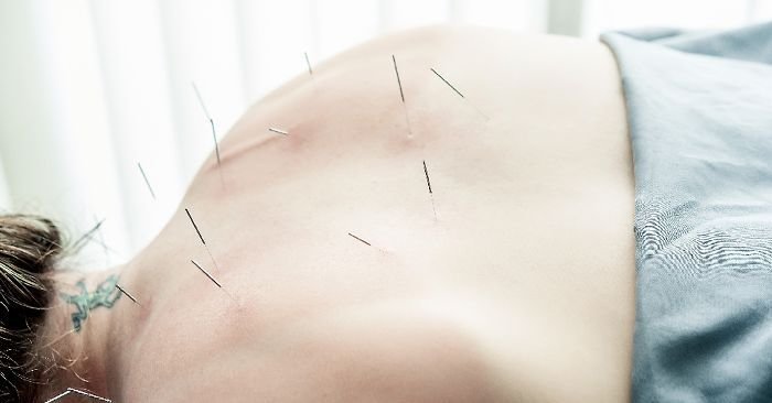 Om Therapy - Centru acupunctura, medicina alternativa