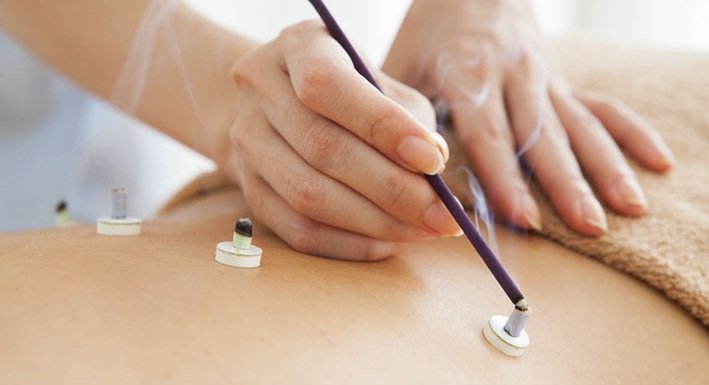 Om Therapy - Centru acupunctura, medicina alternativa